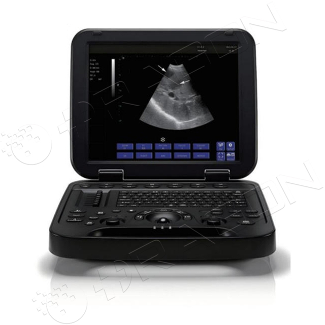 نظام الموجات فوق الصوتية RAD-US06