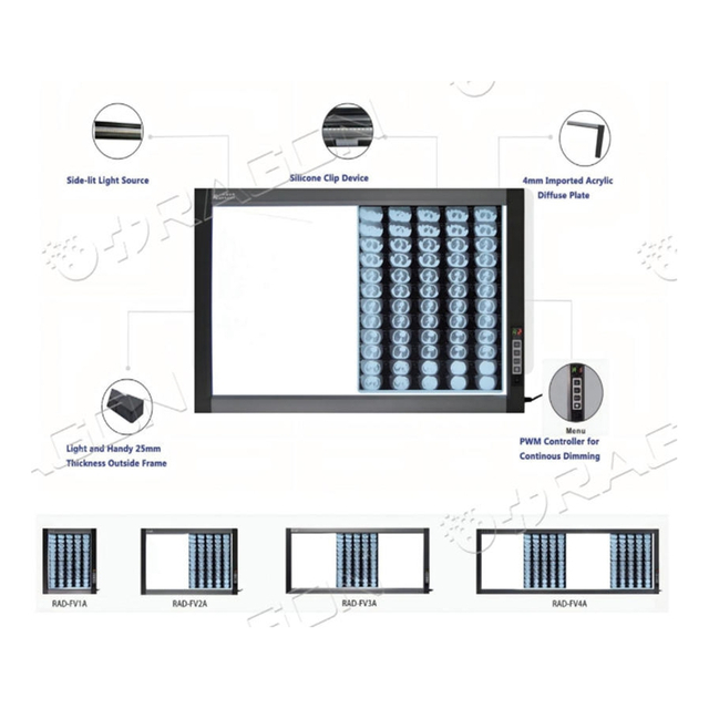 Visore per pellicole X Ray a LED ultrasottile